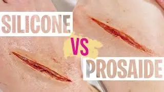 Silicone Prosthetics vs Prosaide Transfers | Pros and Cons