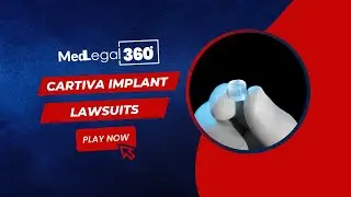 Cartiva Implant Lawsuits