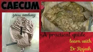 CAECUM - Specimen demo