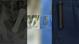 You wont believe why this man went to the hospital 