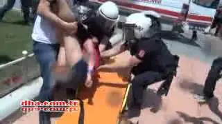 Sol Tarafı Felç Ve Konuşamıyor