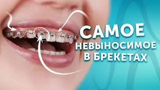 Это важно, но не выносимо в брекетах