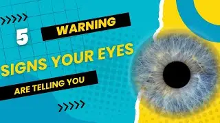 5 WARNING Signs Your Eyes Are Telling YOU
