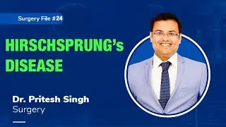 Topic | HIRSCHSPRUNG's DISEASE I Dr. Pritesh SIngh | Surgery