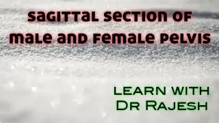 sagittal section of male and female pelvis