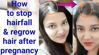 How to stop hairfall after pregnancy