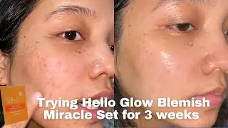Hello Glow Blemish Miracle Set Review