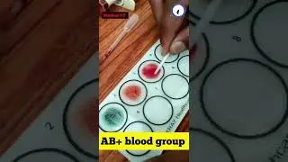 abo blood group | ab positive blood group || blood group #bloodgroup #shorts #viral #dayinthelife