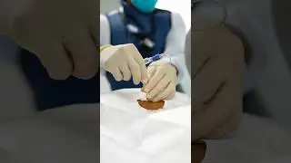 How painful is it to get an epidural? 😣 #painmanagement #backpain #epidural