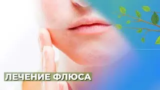 Флюс.Периостит челюсти☘️