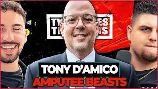 Amputee Beasts | Tony D'Amico