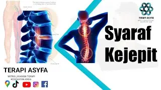 Terapi Syaraf Kejepit