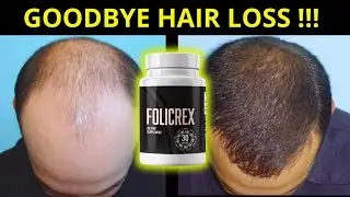 Where to Buy Folicrex: A Quick Guide | FOLICREX REVIEWS
