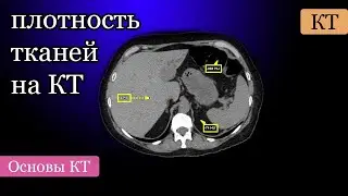 Hounsfield scale and density measurement on CT