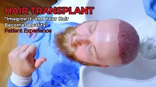 Hair Transplant 2025*