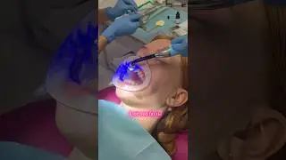 😬БРЕКЕТЫ 