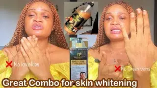 How To Use K brother shower gel and Dr Davis half cast Arbutin lotion to whiten skin in days