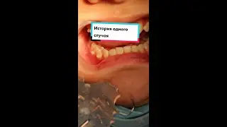 #стоматологалматы #брекетыалматы #ортодонталматы