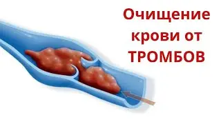 10 продуктов, которые чистят кровь от тромбов