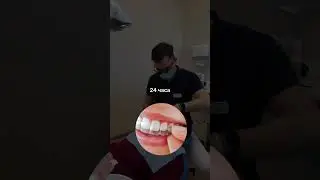 Способы коррекции прикуса