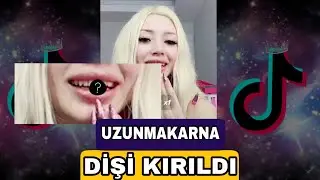Uzunmakarna'nın dişi kırıldı...! | Özgür Balakar