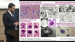 Викулов Г.Х. Респираторные и герпесвирусные инфекции. Алгоритм диагностики и лечения