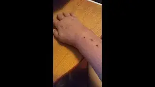 Реабилитация