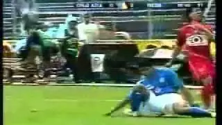 La peor lesión en futbol