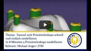 FREE FULL VIDEO - Exocad 2016 Primärteleskope schnell und einfach