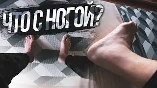ЧТО СЛУЧИЛОСЬ С МОЕЙ СЛОМАННОЙ НОГОЙ? В МЕНЯ СТРЕЛЯЛИ ИЗ АВТОМАТА. КУПИЛ ГОУПРО 6.