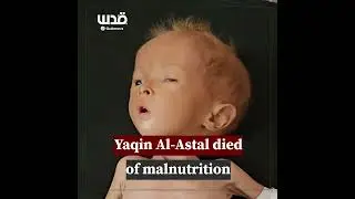 ⭕️ 💔 🇵🇸  Le nourrisson Palestinien 🇵🇸 Yaqin Al-Ashtal a succombé ce matin à une malnutrition