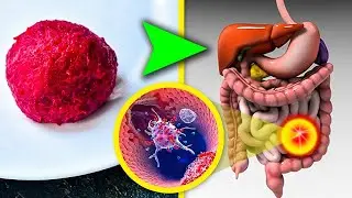 عادات غذایی اشتباهاتی که عامل بروز بیماری های روده میشوند