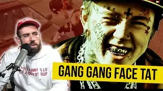 Why does this Rapper have a 