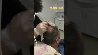Saç dökülmesi ve kellik Tedavisi