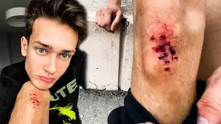 I ALMOST BROKE MY ANKLE. PARKOUR FAIL.