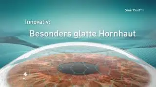 TRANS PRK smart surface bei EyeLaser