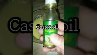 Alopecia & Hair fall dry demigod hair #best #viral