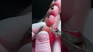Мозоль на пятом пальце ноги. Косметика PinkRoyss 
