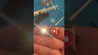 Два варианта начинки глазного протеза