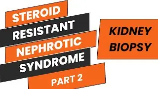 STEROID RESISTANT NEPHROTIC SYNDROME PART 2 | NEPHROTIC SYNDROME | KIDNEY BIOPSY | DR.KUNAL PAI