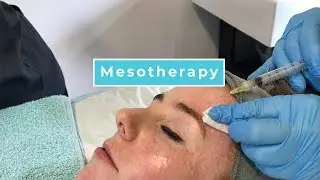 Mesotherapy With Anna