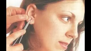 Как выдавить черные точки в ушах