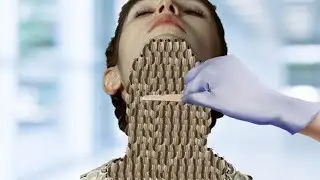 ASMR Treatment 2D Animation | Maggot Infected Neck, Remove Dog Ticks | @HealAsmr914K