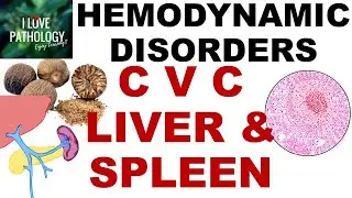 CVC Liver& Spleen: Pathogenesis, Gross & Microscopy
