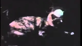 Flynn hypothalamic stimulation