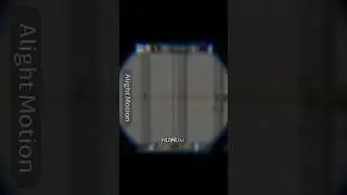 кила не видна ;( 