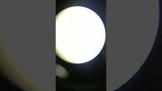 bacteria present in urine sample