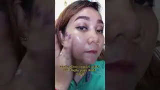 everpure calm omild essence serum shopee aymp_skincare