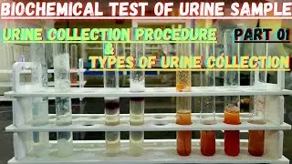 Biochemical Test of Urine Sample - Urine Collection Procedure and Types of Urine Collection
