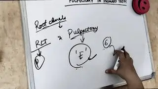 pulpectomy procedure in primary teeth (special rct)